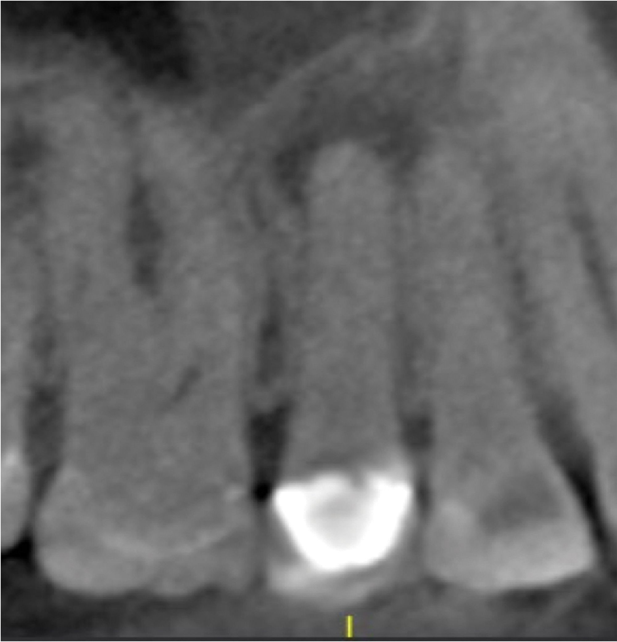 How to Use Imaging and Treatment Planning Software for Guided